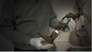 Fodprotese på Medicinsk Museion