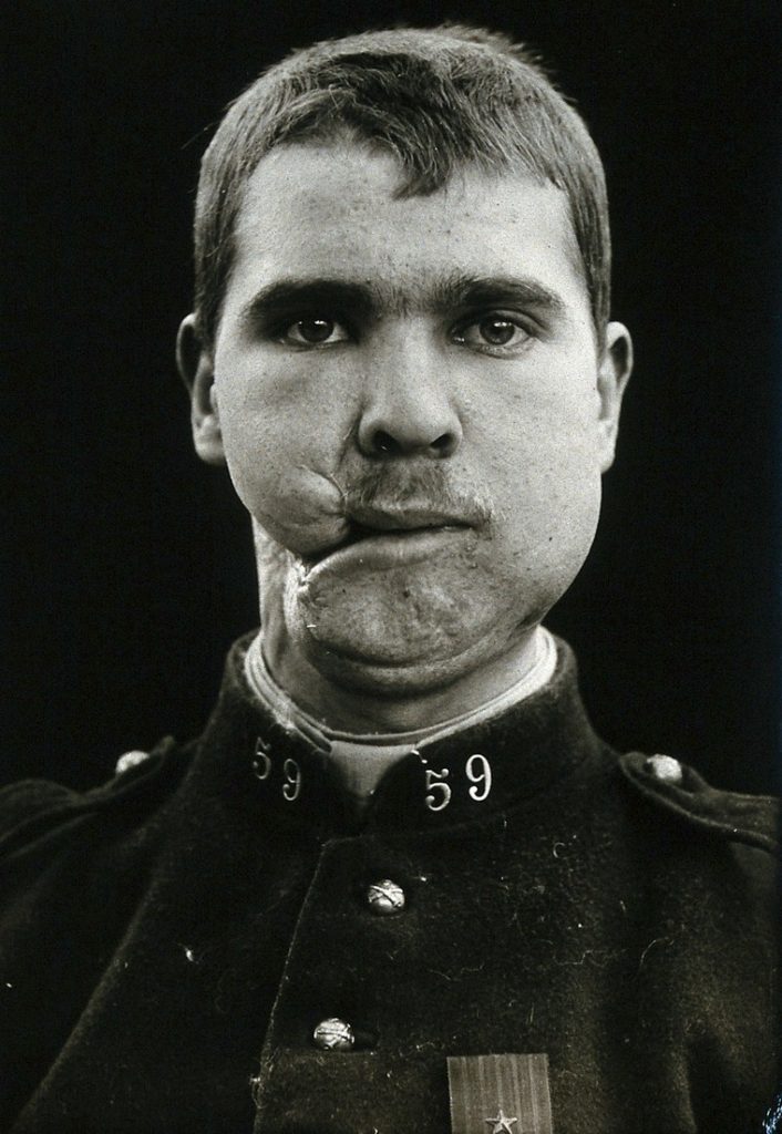 Billede af krigens ansigt