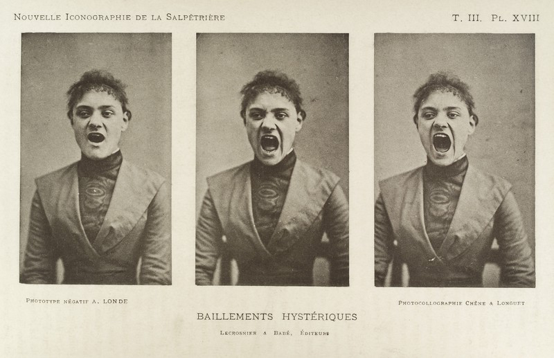 Series of three photos showing a so-called hysterical woman yawning_Wellcome Collection.